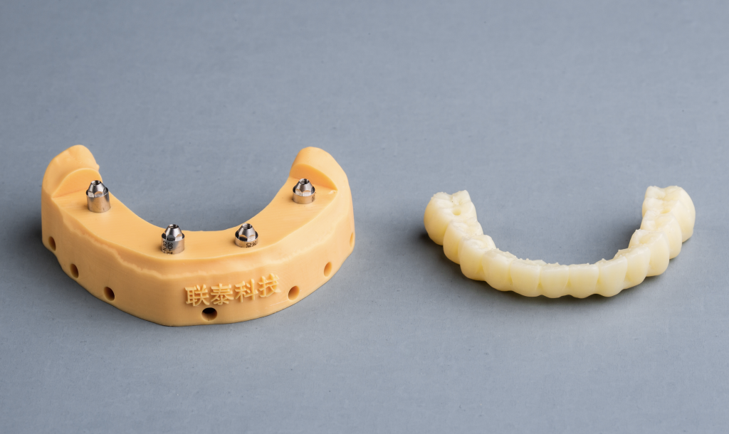 3D Printed Implant-Supported Prosthetics