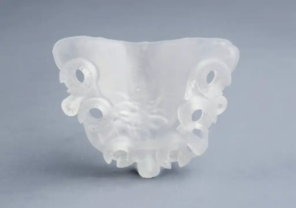 Translucent Dental Device 