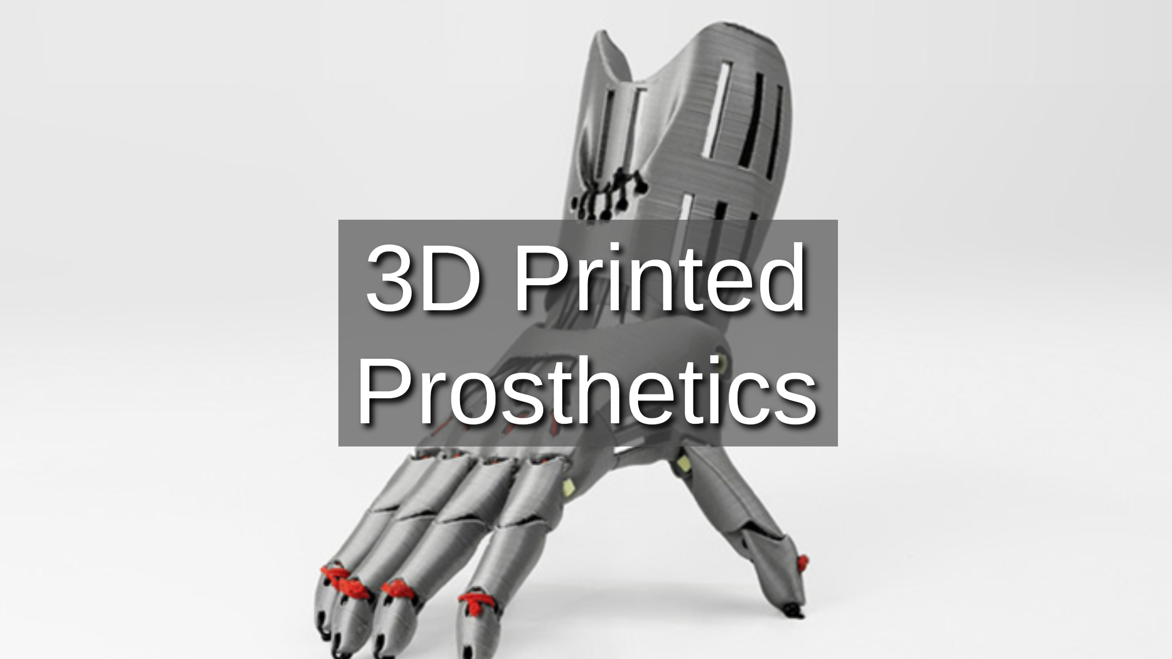 3D Printed Prosthetics: Innovations in Rehabilitation