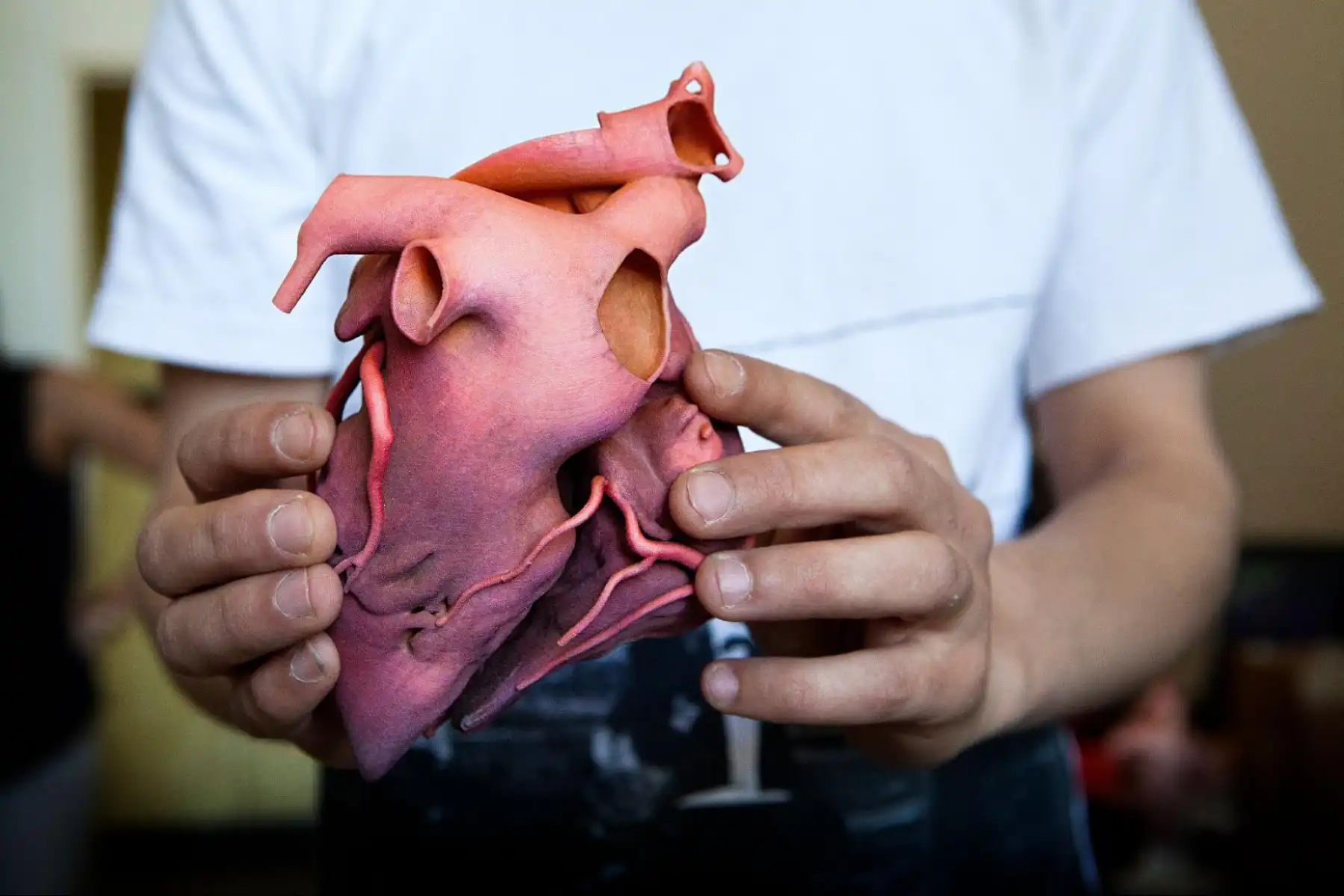 3d-printed human heart