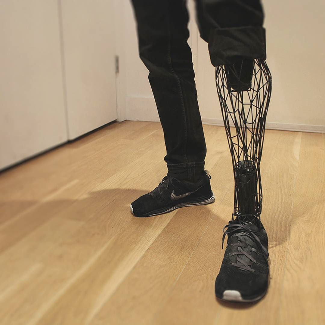 3D printed flexible prosthetics